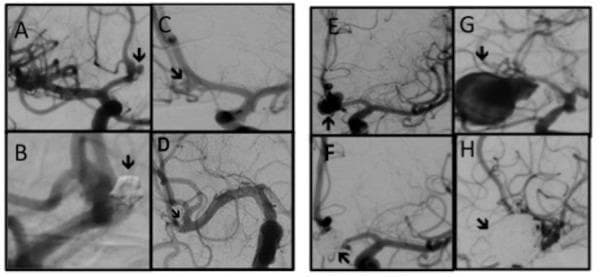 Hugging Face pmc clinical VQA raw