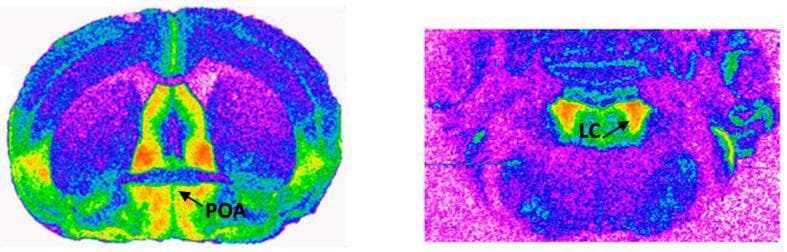 This figure presents two pseudocolor autoradiograms illustrating the distribution and density of alpha2-adrenergic receptors in rodent brain sections. The left image shows a coronal section at the level of the preoptic area (POA), where high receptor density is indicated by warm colors (red and orange) in a centrally located, elongated region along the ventral aspect. The surrounding neural tissue exhibits lower binding density, represented by cooler colors (green, blue, and purple). The right image displays a more posterior section at the level of the locus coeruleus (LC). In this section, high alpha2-adrenergic receptor density is concentrated in a compact, localized area within the LC itself, demarcated in bright orange and red. These images demonstrate neuroanatomical variations in receptor expression, with the POA showing a more diffuse ventral distribution compared to the highly focused concentration in the LC. Such visual data is essential for understanding catecholaminergic signaling pathways and the pharmacological mapping of adrenergic receptors in the central nervous system.