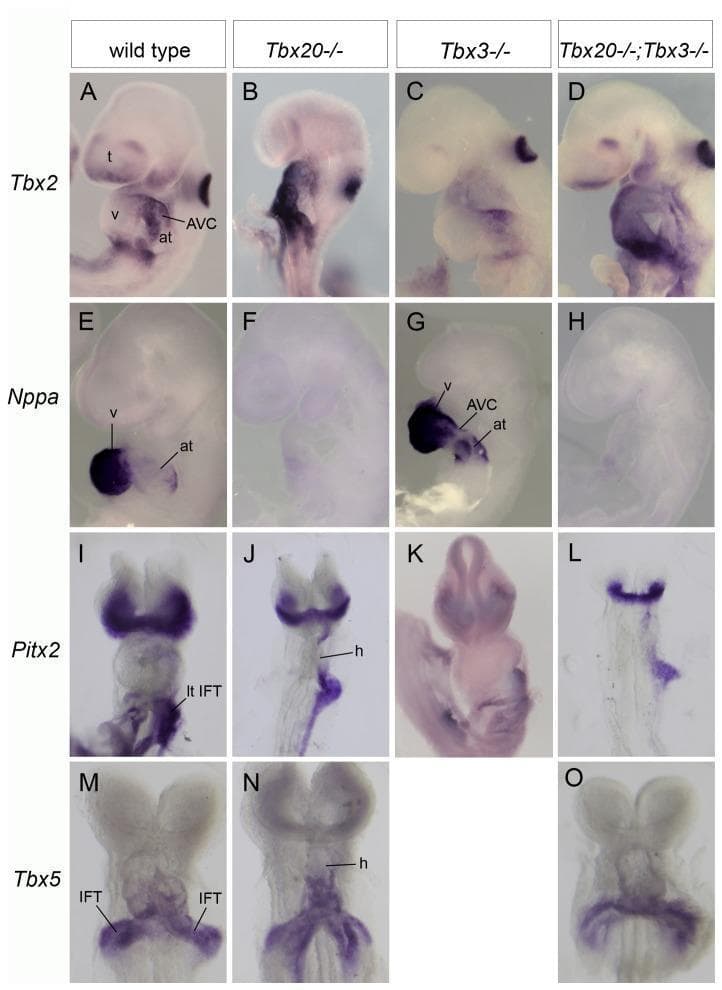 This Comparison Chart displays whole-mount in situ hybridization (ISH) results from mouse embryos at stages E8.5 to E9.25, illustrating the developmental genetics of cardiac chamber formation and patterning. The panel compares four genotypes across rows representing different cardiac marker genes: Tbx2, Nppa, Pitx2, and Tbx5. The vertical columns represent wild type, Tbx20-/-, Tbx3-/-, and double homozygous Tbx20-/-; Tbx3-/- mutants. Key observations include: 1) Tbx2 expression, normally restricted to the atrioventricular canal (AVC), becomes ectopically expanded throughout the heart in Tbx20-/- and double mutants. 2) Nppa (NPPA), a marker for chamber myocardium, is severely down-regulated in Tbx20-/- and double mutants, indicating a failure of chamber differentiation, while being precociously upregulated in the atrium of Tbx3-/- mutants. 3) Pitx2 and Tbx5 expression patterns remain relatively preserved across genotypes at E9.25. Labeled structures include the atrium (at), ventricle (v), telencephalon (t), and inflow tract (IFT). This material is designed for advanced medical education in embryology and molecular cardiology, focusing on transcriptional regulation of heart development.