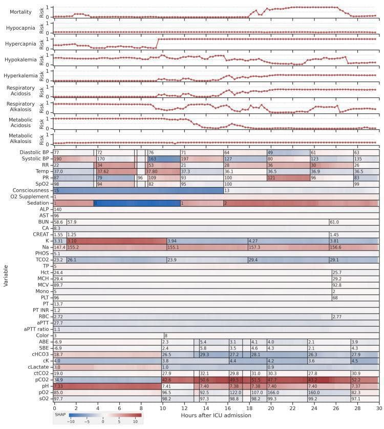 This infographic presents a feature visualization and model output dashboard for a single patient over a 30-hour Intensive Care Unit (ICU) stay. The top section contains time-series line graphs depicting predicted risk scores (0 to 1) for various clinical conditions, including Mortality, Hypocapnia, Hypercapnia, Hypokalemia, Hyperkalemia, and several types of Acid-Base imbalances (Respiratory/Metabolic Acidosis/Alkalosis). Below the risk scores, a heatmap-style grid displays longitudinal clinical variables, including vital signs (Systolic/Diastolic BP, Heart Rate, SpO2, Respiratory Rate, Temperature), consciousness levels, and laboratory results (Electrolytes, Renal Function, Blood Gas Analysis). Individual cells are color-coded based on SHAP (SHapley Additive exPlanations) values, ranging from blue (negative contribution to risk) to red (positive contribution to risk). This visualization assists in identifying specific physiological trends, such as fluctuating blood pressure and electrolyte imbalances, and provides explainable machine learning insights into which clinical parameters most significantly drive the model’s risk predictions at different time intervals.