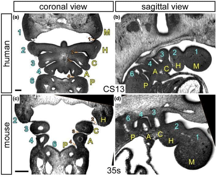 High-resolution episcopic microscopy (HREM) images illustrating the comparative embryological anatomy of the pharyngeal region in a human embryo (Carnegie Stage 13) and a mouse embryo (35 somites). The plate includes coronal (transverse) and sagittal sections, highlighting the segmental organization of pharyngeal arches and pouches. The images contrast the traditional numerical nomenclature (1, 2, 3, 4, 6) with a proposed descriptive naming system: Mandibular (M), Hyoid (H), Carotid (C), Aortic (A), and Pulmonary (P). In the human coronal view (a), bilateral symmetry of the arches is visible, while the sagittal view (b) clearly depicts the cranial-to-caudal sequence of these structures. Pharyngeal pouches are numerically labeled (1-4, 6) in orange, representing endodermal outpocketings between the arches. This visual resource is designed for developmental biology and embryology education, emphasizing that there are five distinct arches formed during normal amniote development, which has significant implications for understanding congenital cardiac malformations and the derivatives of the pharyngeal apparatus.