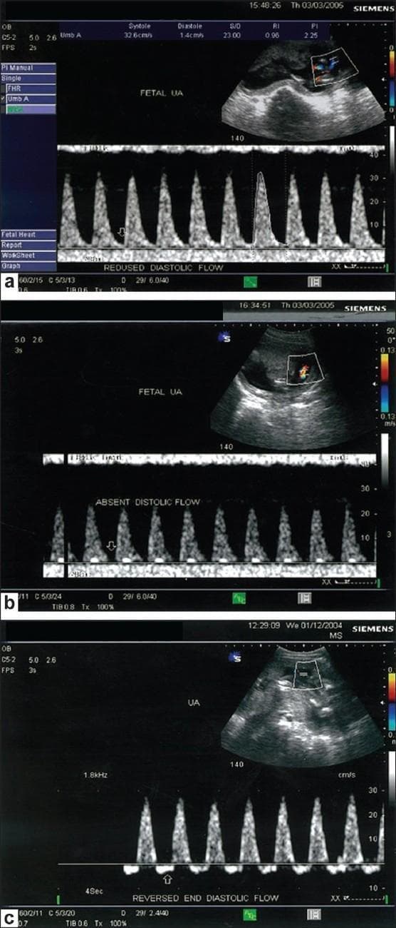 Hugging Face pmc clinical VQA raw