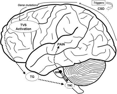 This pathophysiology diagram illustrates the neurological pathways involved in migraine pain generation within a schematic human brain. The process begins externally with 'Triggers' leading to Cortical Spreading Depression (CSD), depicted as a curved arrow over the cerebral cortex. An oval labeled 'TVS Activation' (Trigemino-Vascular System) is situated in the frontal lobe, influenced by 'Gene mutations.' A dotted signaling pathway descends from the TVS to the 'TG' (Trigeminal Ganglion) and subsequently to the 'TNC' (Trigeminal Nucleus Caudalis) located in the brainstem. The TNC receives modulatory input from 'BN' (brainstem nuclei), such as the periaqueductal gray or locus coeruleus. Finally, a dotted arrow ascends from the brainstem toward the somatosensory areas of the cortex, labeled 'PAIN,' representing the perception of a migraine attack. This diagram serves as an educational tool for understanding the trigeminovascular system's role and the transition from cortical excitation to sensory pain perception in pediatric and adult migraine pathology.