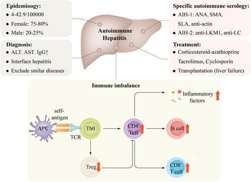 Educational infographic regarding Autoimmune Hepatitis (AIH), summarizing clinical data and immunopathogenesis. The top section displays a liver illustration surrounded by diagnostic and epidemiological summaries. Epidemiology notes a female predominance (75-80%) and prevalence of 4-42.9/100,000. Diagnostic criteria include elevated ALT, AST, and IgG, interface hepatitis, and specific serology: AIH-1 (ANA, SMA, SLA, anti-actin) and AIH-2 (anti-LKM1, anti-LC). Treatment modalities listed include corticosteroids, azathioprine, tacrolimus, cyclosporin, and liver transplantation. The bottom panel illustrates 'Immune imbalance' mechanisms: an Antigen-Presenting Cell (APC) presents self-antigen via a T-cell receptor (TCR) to a naïve T helper cell (Th0). This triggers a pro-inflammatory cascade where CD4+ effector T cells (Teff), B cells, and CD8+ T cells are upregulated (indicated by red upward arrows), leading to increased inflammatory factors. Simultaneously, regulatory T cells (Tregs) are downregulated (indicated by a red downward arrow), resulting in a loss of suppression on Teff and CD8+ cells. This diagram effectively demonstrates the loss of immune tolerance and effector-to-regulatory cell imbalance characteristic of AIH.
