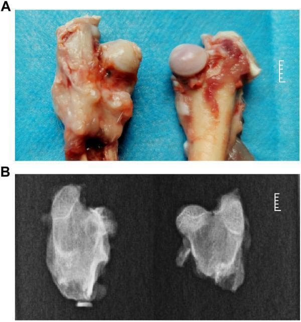 This composite educational image illustrates the phenotypic hallmarks of Legg-Calvé-Perthes disease (Perthes disease) in a rabbit model compared to a healthy control. Panel A presents a gross clinical photograph of excised proximal femurs. The Perthes model (left) shows a misshapen, flattened femoral head with a pale, opaque surface and loss of normal articular gloss. In contrast, the healthy control (right) displays a smooth, spherical, and glistening femoral head. Panel B shows corresponding X-ray diagnostic images. The Perthes disease specimen (left) exhibits a loss of spherical structure, heterogeneous bone density (sclerosis and lucency), and focal collapse of the femoral head epiphysis. The healthy control (right) demonstrates uniform bone density and a well-preserved, rounded epiphysis. This visual comparison highlights the osteonecrotic changes, structural deformity, and cartilage thickening characteristic of ischemic necrosis of the femoral head, modeling the clinical progression observed in pediatric patients. The images serve as a comparative reference for orthopedic pathology and experimental models of avascular necrosis.