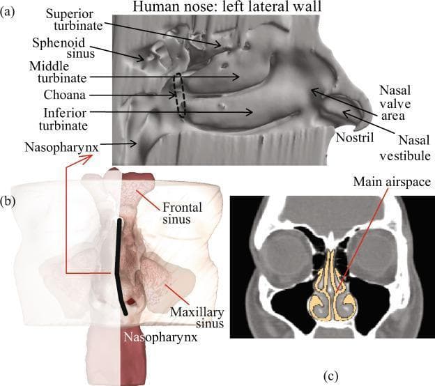 This medical illustration presents three anatomical views of the human sinonasal cavity. Panel (a) shows a detailed sagittal cut-away of the left lateral nasal wall, labeling the superior, middle, and inferior turbinates, the sphenoid sinus, the posterior choana, and the nasopharynx. Anterior features include the nasal valve area, nostril, and nasal vestibule. Panel (b) provides a 3D volumetric rendering of the sinonasal complex, highlighting the frontal and maxillary sinuses and the nasopharynx, with a black line indicating the sagittal plane used in the first view. Panel (c) is a representative coronal computed tomography (CT) scan through the mid-nasal cavity, where the main nasal passage and airway are highlighted in a contrasting light yellow color to demonstrate the cross-sectional patency. This figure is designed for educational instruction on nasal anatomy, specifically focusing on the complex geometry relevant to intranasal drug delivery and airflow dynamics within the respiratory tract.