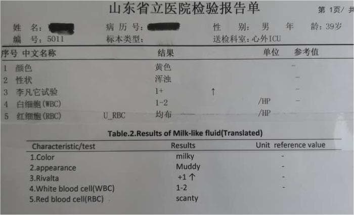 A clinical laboratory report document presented in both original Chinese and translated English, detailing a 'milk-like fluid analysis'. The report header identifies the patient as a 39-year-old male from a Cardiac Surgery Intensive Care Unit (ICU). The data table presents five key parameters: Color (milky/yellow), Appearance (muddy/turbid), Rivalta test (result of +1, indicating the presence of serous exudate protein), White blood cell (WBC) count (1-2 per high-power field), and Red blood cell (RBC) count (described as scanty or homogeneous). This fluid was obtained clinically during a pericardiectomy for localized chronic constrictive pericarditis (CP). The laboratory findings help characterize the fluid gush (chylopericardium vs. inflammatory exudate) encountered during the surgical decompression of the calcified pericardium.
