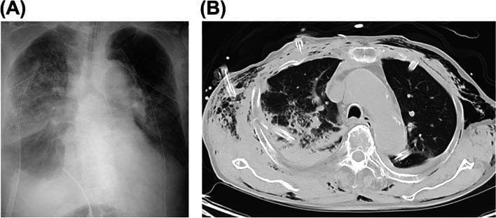 Hugging Face pmc clinical VQA raw