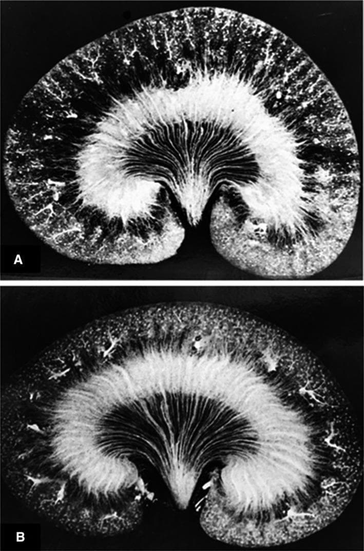 This diagnostic image displays two cross-sectional views of rat kidneys (Figure 1A and 1B) utilizing Microfil injection to visualize the renal microvasculature. Figure 1A demonstrates a normally hydrated (euvolemic) state, showing a dense, uniform filling of all renal zones, including the superficial and deep cortex, as well as the outer and inner medulla. The glomerular and peritubular capillaries are clearly defined. In contrast, Figure 1B illustrates the kidney after 16 hours of water deprivation (dehydration). This image shows a visibly altered pattern of postglomerular microcirculation, characterized by less dense vascular filling and reduced perfusion in the cortical regions compared to the control. The vasa recta in the medullary regions appear less robustly filled. This comparison is used in renal physiology to demonstrate how hydration status influences intrarenal blood flow distribution and vascular resistance across different capillary beds.