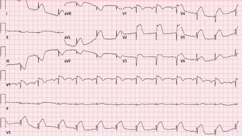 Hugging Face pmc clinical VQA raw