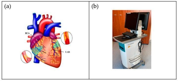 The visual content is composed of two educational panels focused on coronary artery disease (CAD) and intravascular ultrasound (IVUS) technology. Panel (a) is an anatomical diagram of a human heart illustrating the coronary circulation. It highlights the Right Coronary Artery (RCA) and the Left Anterior Descending (LAD) artery. Two inset circular cross-sections demonstrate the pathophysiology of atherosclerosis: one shows a healthy, patent vessel with a smooth lumen, while the other depicts a diseased vessel with yellow atherosclerotic plaque causing significant luminal narrowing (stenosis). The large vessels, including the aorta (red) and pulmonary artery (blue), provide anatomical context. Panel (b) is a clinical photograph of an IVUS acquisition system. The medical equipment is a mobile workstation featuring a high-resolution monitor for real-time cross-sectional vessel imaging, a keyboard/input console, and a wheeled base. This dual-panel image illustrates the clinical application of imaging technology in diagnosing and managing coronary atherosclerosis and guiding percutaneous coronary interventions (PCI).