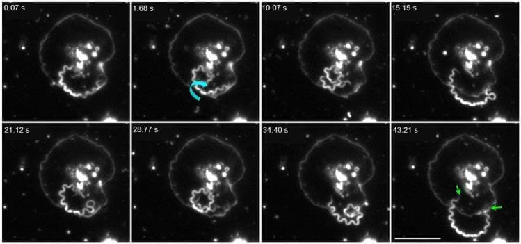 This darkfield video microscopy time series (1000x magnification) illustrates the dynamic interaction between the spirochete Treponema pallidum and a human platelet over a period of 43.21 seconds. The imagery displays a single treponeme, characterized by its distinctive helical morphology, interacting with a fully activated, spread platelet. The sequence captures various behavioral states: at 1.68 s, a cyan curved arrow indicates coiling and vigorous axial rotation against the platelet membrane. In subsequent frames (15.15 s – 34.40 s), the spirochete is seen extending away from or above the platelet surface. The final frame at 43.21 s highlights tip-mediated adhesion, where green arrows point to both distal ends of the treponeme anchored to the platelet membrane. This visual evidence demonstrates the ability of T. pallidum to recognize and physically engage with activated components of the human hemostatic system. A 10 μm scale bar is provided for reference in the final frame.