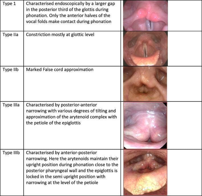 A clinical comparison chart displaying five endoscopic views of the human larynx, illustrating different types of Muscle Tension Dysphonia (MTD) patterns (Types I–III). Each entry consists of a diagnostic photograph and a brief descriptive text of the glottic and supraglottic configurations during phonation. Type 1 shows a posterior glottic gap where only the anterior halves of the vocal folds contact. Type IIa involves constriction primarily at the glottic level, while Type IIb demonstrates marked approximation of the false vocal cords (ventricular folds). Type IIIa is characterized by posterior-anterior narrowing with tilting and approximation of the arytenoid complex toward the epiglottic petiole. Type IIIb shows anterior-posterior narrowing with the arytenoids positioned near the posterior pharyngeal wall and the epiglottis locked in a semi-upright position. These laryngeal hyperfunction patterns are used in otorhinolaryngology and speech-language pathology to classify primary MTD, typically associated with voice misuse or abuse rather than organic pathology.