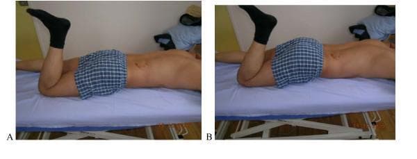 This clinical photograph displays a side-by-side comparison (A and B) of a Prone Lying Active Knee Flexion test, used to assess motor control of the lumbar spine and pelvis. The subject is positioned prone on an examination table. In Image A (Correct), the subject performs active knee flexion to 90 degrees while maintaining a neutral lumbar spine and stable pelvic alignment, with the torso remaining in contact with the bed. In Image B (Incorrect), the same movement results in a compensatory lumbo-pelvic dysfunction; as the knee flexes, the lower back exhibits an anterior pelvic tilt and lumbar extension (arching), creating visible space between the lower back and the table surface. This visual demonstrates movement impairment where the subject fails to dissociate knee flexion from spinal movement, suggesting a lack of lumbopelvic stability or 'extension control' dysfunction in the context of physical therapy and orthopedic assessment.