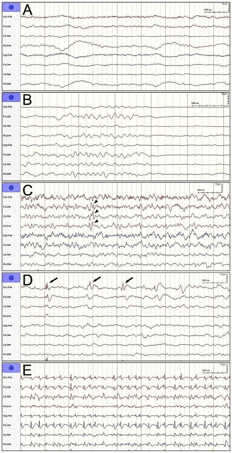 Hugging Face pmc clinical VQA raw