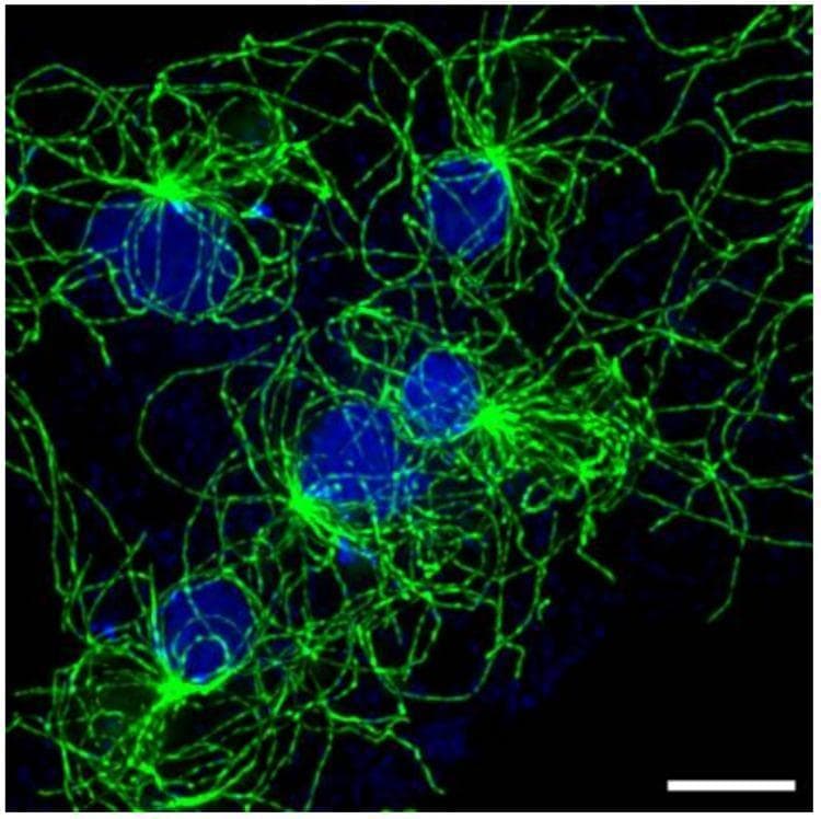 This fluorescence microscopy image depicts a large, flattened multinucleated cell, a common pathological or experimental finding in cell biology (syncytium). Five distinct blue-stained nuclei are visible within a single shared cytoplasm. Associated with each nucleus is a green-stained microtubule (MT) array originating from a bright focal point, the centrosome (or nucleus-associated body). These MT arrays exhibit a radial, star-like morphology, with filaments extending throughout the cytoplasm. A key educational feature shown is the spatial segregation of these arrays; despite sharing the same cytoplasmic space, the individual microtubule asters maintain distinct boundaries with minimal bundling or intermingling between neighboring arrays. This illustrates mechanisms of cellular spatial organization and centrosome-nucleus coupling. The scale bar in the bottom right corner represents 5 μm, emphasizing the large dimensions of this multinucleated interphase cell.