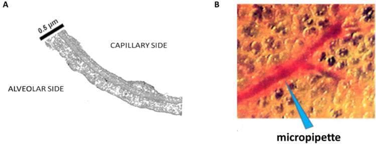 This figure illustrates the functional anatomy and experimental study of the pulmonary gas exchange interface. Panel A is a high-magnification electron micrograph cross-section of the thin portion of the human air-blood barrier. It demonstrates the structural juxtaposition of the 'Alveolar Side' and 'Capillary Side,' separated by an ultrathin fused basement membrane. A scale bar indicates a thickness of approximately 0.5 ̇μm, highlighting the specialized morphology required for efficient passive gas diffusion. Panel B presents an in vivo trans-pleural diagnostic image showing the pulmonary microvascular network. The microvessels appear as a branching red vascular structure embedded within the brownish-orange alveolar parenchymal tissue. A blue arrow identifies a micropipette positioned to puncture the peri-microvascular interstitial space, an experimental technique used to measure pulmonary interstitial pressure (Pi). Collectively, these panels demonstrate the delicate balance of the Starling forces and the structural vulnerability of the respiratory membrane in conditions like pulmonary edema.