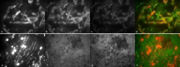 Fluorescence microscopy panels demonstrating the challenges of assessing Fluorescence In Situ Hybridization (FISH) signals in tissue specimens with invasive aspergillosis. The images are organized into two rows (a-d and e-h) across four channels: DAPI (nucleic acid stain), FITC (eukaryotic universal probe univ-SSU), Cy-3, and a composite fusion of DAPI and FITC channels. Panels a-d illustrate autofluorescence of mould hyphae, where the filamentous structures show non-specific signal in both DAPI and FITC channels, appearing as multi-colored orange and green structures in the fusion image (d). Panels e-h show high background autofluorescence from the surrounding human tissue, particularly in the FITC channel (f), which obscures the specific hybridization signals. In the DAPI channel (e), host cell nuclei are intensely stained. The composite image (h) displays red-stained nuclei against a diffuse green background. These images highlight how intrinsic fluorescence of fungal hyphae and host tissue can impair the diagnostic evaluation of ribosomal RNA probes in fungal pathology.
