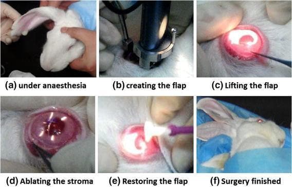 A series of six intraoperative clinical photographs (labeled a-f) documenting the sequential steps of Laser-Assisted In Situ Keratomileusis (LASIK) surgery, using a rabbit model for ophthalmological research.
(a) Pre-operative stage: The subject is positioned under general anesthesia.
(b) Flap creation: A mechanical microkeratome is applied to the corneal surface to create a thin, hinged corneal flap.
(c) Flap elevation: A surgical spatula is used to lift the flap, exposing the underlying corneal stroma, visible under a bright operating microscope light.
(d) Photoablation: An excimer laser is used to perform stromal ablation, modifying the corneal curvature; the stroma appears altered and reflective.
(e) Flap repositioning: The corneal flap is carefully smoothed back into its original anatomical position using a specialized sponge-tip applicator to ensure proper adhesion.
(f) Post-operative view: The procedure is complete, demonstrating the restoration of corneal integrity.
This image serves as an educational resource for refractive surgery protocols, demonstrating instrument application and corneal tissue response during the transition from flap creation to laser ablation and restoration.