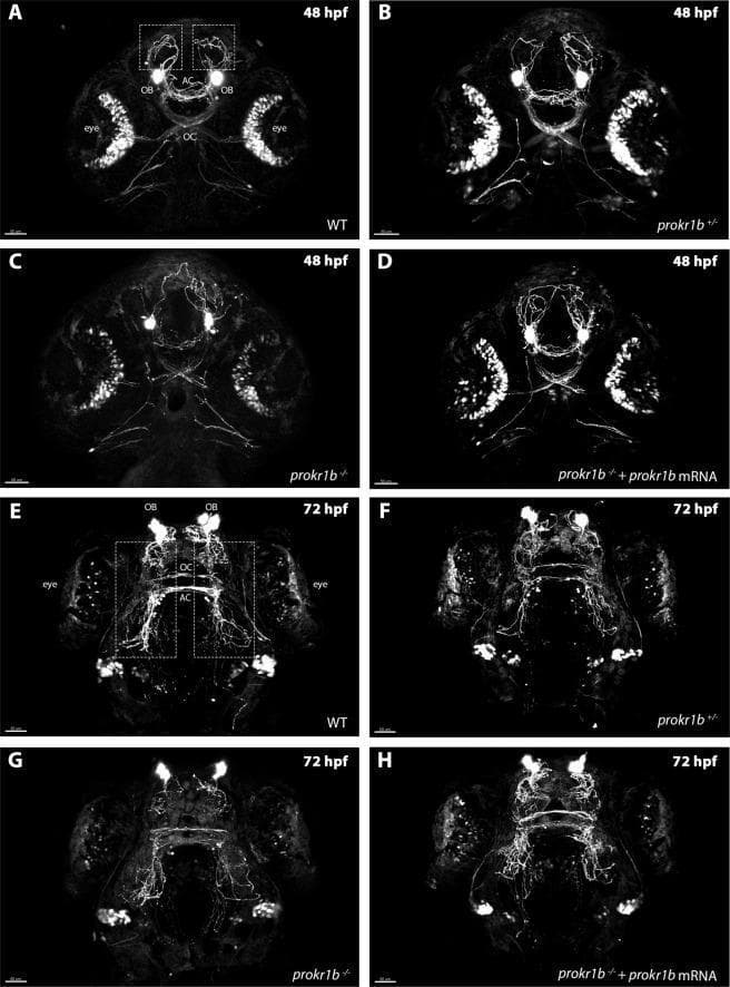 This set of fluorescence microscopy images illustrates the development of the GnRH3 neuron fiber network in zebrafish embryos (tg(gnrh3:EGFP)) at 48 hours post-fertilization (hpf) and 72 hpf across different genotypes. Panels A and E show wild-type (WT) embryos with highly organized fiber distribution throughout the olfactory bulbs (OB), optic chiasm (OC), and anterior commissure (AC). Panels B and F demonstrate that prokr1b heterozygous mutants retain a similar organized architecture. In contrast, prokr1b homozygous mutants (Panels C and G) exhibit significant axon misrouting and disorganization, particularly at the rostral region and the optic chiasm. Panels D and H demonstrate a successful phenotypic rescue in homozygous mutants following the injection of wild-type prokr1b mRNA, restoring the structural integrity of the GnRH3 network. This comparative visualization highlights the critical role of the prokr1b gene in guiding the migration and pathfinding of GnRH neurons, which is medically relevant for understanding the molecular basis of Kallmann syndrome and related hypogonadotropic hypogonadism disorders.