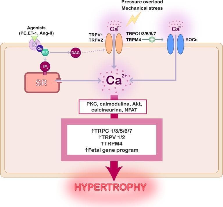 A pathophysiology diagram illustrating the signaling pathways of TRP channels in cardiac hypertrophy. The diagram depicts the plasma membrane containing several ion channels: TRPV1/2, TRPC1/3/5/6/7, TRPM4, and SOCs. Activation occurs via two main stimuli: mechanical stress/pressure overload and hypertrophic agonists (PE, ET-1, Ang-II) binding to Gq-protein coupled receptors (GPCR). The GPCR pathway activates PLC, generating DAG and IP3; IP3 triggers calcium release from the sarcoplasmic reticulum (SR). Simultaneously, mechanical stress and receptor-mediated signaling promote calcium influx through the TRP channels. The resulting elevation in intracellular calcium (Ca2+) concentration activates a downstream cascade of signaling proteins, including PKC, calmodulin, Akt, calcineurin, and NFAT. This cascade leads to the upregulation of TRP channel expression and the activation of a fetal gene program, ultimately resulting in cellular hypertrophy. The illustration uses color-coded icons and directional arrows to trace the metabolic and mechanical pathways contributing to pathological heart remodeling.