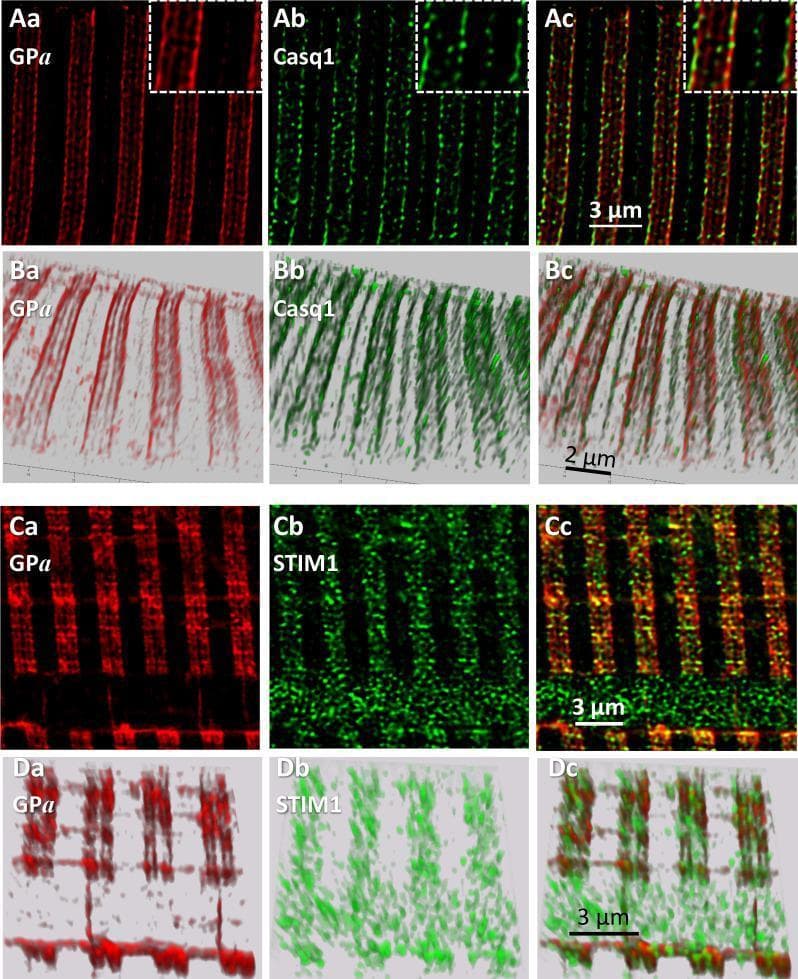 This composite diagnostic image displays high-resolution confocal fluorescence microscopy sections (A, C) and 3D renderings (B, D) of human myofibers, illustrating the spatial localization of key calcium handling and metabolic proteins. Panels Aa-Ac and Ba-Bc show co-staining for phosphorylated glycogen phosphorylase (GPa, red) and Calsequestrin 1 (Casq1, green). Both proteins delineate the terminal cisternae (TC) of the sarcoplasmic reticulum (SR) within skeletal muscle triads, appearing as parallel double bands. While closely apposed, GPa and Casq1 show close proximity without direct colocalization. Panels Ca-Cc and Da-Dc illustrate the relationship between GPa (red) and Stromal Interaction Molecule 1 (STIM1, green). GPa maintains its delineation of the TC, while STIM1 forms distinct clusters adjacent to the GPa bands. The imagery resolves the two TC within a single triad junction at a resolution of approximately 100 nm, highlighting the structural organization of the sarcoplasmic reticulum and the recruitment of glycogenolytic enzymes like GPa to these calcium-rich sub-compartments.