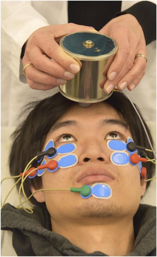 This clinical photograph demonstrates the experimental setup for recording repetitive ocular vestibular evoked myogenic potentials (roVEMP). The procedure involves a patient in a supine position with maximal upward gaze to facilitate recording from the inferior oblique extraocular muscles. A handheld cylindrical metallic mini-shaker is applied to the midline of the forehead at the hairline (standard AFz point) to deliver bone-conducted vibration stimuli. Recording is achieved via a multi-electrode montage on the face: active electrodes (black leads) are placed at the infraorbital margins, reference electrodes (red leads) are positioned directly below them, and a grounding electrode (green lead) is attached to the chin. All electrodes are secured with light-blue adhesive pads. This neurophysiological setup is used to assess vestibular function and neuromuscular transmission, specifically in the diagnosis and monitoring of conditions such as ocular myasthenia gravis, where fatigue or decrement in muscle response to repetitive stimulation is clinically significant.