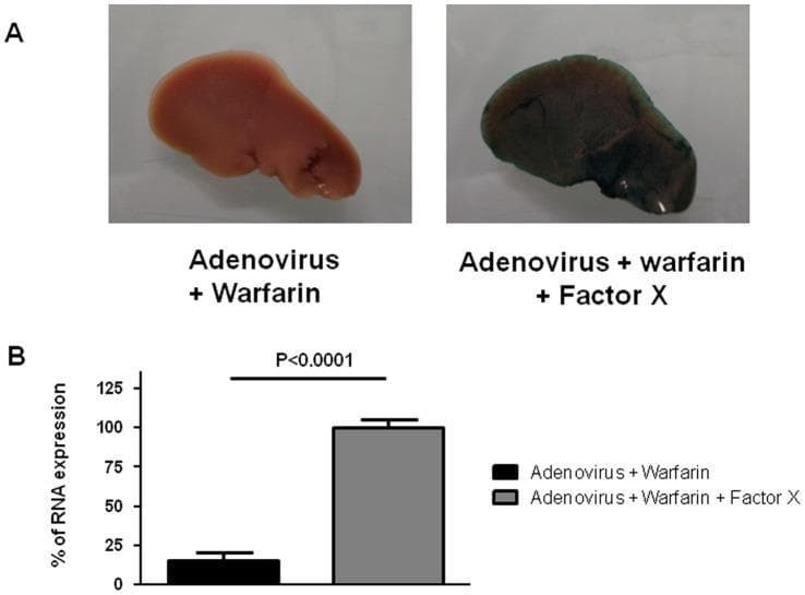 This composite educational image, categorized as Clinical Imaging/Specimen, illustrates the role of blood coagulation Factor X in adenovirus transduction using a mouse model. Panel A presents two gross liver specimens stained for β-galactosidase activity (Lac-Z reporter gene). The specimen labeled 'Adenovirus + Warfarin' appears pale pink/tan, indicating minimal viral transduction due to warfarin-induced depletion of vitamin K-dependent factors. In contrast, the 'Adenovirus + Warfarin + Factor X' specimen shows intense dark blue-green staining across the hepatic surface, demonstrating that exogenous Factor X supplementation restores adenoviral infection. Panel B contains a corresponding bar graph quantifying the percentage of RNA expression in adrenal glands. The 'Adenovirus + Warfarin' group (black bar) shows significantly lower expression compared to the 'Adenovirus + Warfarin + Factor X' group (gray bar), which is set as the 100% reference point. Statistical significance is indicated by a p-value < 0.0001. This figure demonstrates that adenovirus type 5 infection in both liver and adrenal tissues is dependent on Factor X, bypassing traditional CAR receptor-mediated pathways.