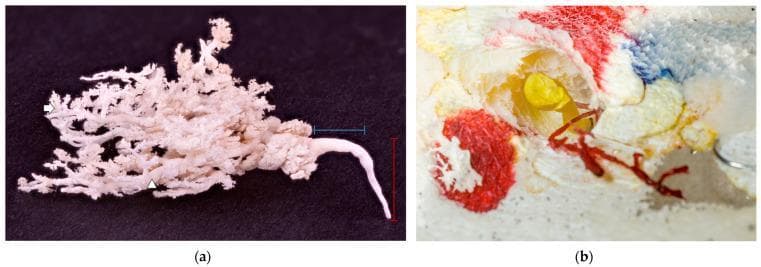 This composite educational image features corrosion casts of mammary gland anatomy. Figure (a) displays a white glandular cast against a black background, illustrating the complex branching architecture of the ductal system. It shows a primary ascendant milk duct (vertical red marker) transitioning into a wider transversal duct (horizontal blue marker) before arborizing into numerous secondary ducts (white arrowhead) and distal clusters representing terminal alveoli (white arrow). The absence of a prominent teat cistern is a notable anatomical variation. Figure (b) demonstrates a cross-sectional view of resin-perfused ducts within preserved tissue. A primary duct is filled with yellow resin, showing the hollow structure of the teat canal, while an adjacent underdeveloped, blind-ended duct is filled with red resin. These casts are used in anatomical research to study ductal morphology, lobation patterns, and developmental variations such as atrophic or rudimentary ducts, providing insight into physiological milk drainage and the potential pathways for disseminated infections.
