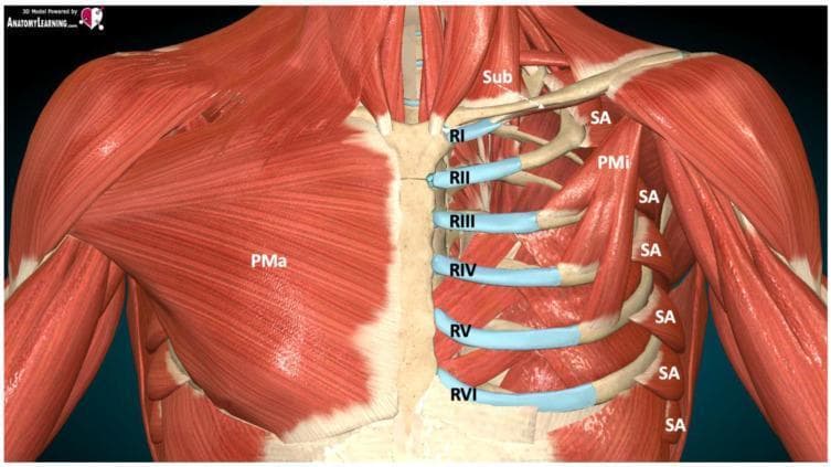 Anatomical diagram of the anterior and lateral thoracic wall muscles and skeletal structures. On the right side of the image (anatomical left), the pectoralis major (PMa) is shown as the most superficial layer. On the left side of the image (anatomical right), the pectoralis major is removed to reveal deeper structures. Key muscles include the pectoralis minor (PMi) originating from ribs III-V, the serratus anterior (SA) with its characteristic digitations on the lateral rib cage, and the subclavius (Sub) muscle inferior to the clavicle. The skeletal system is represented by the sternum and ribs I through VI (RI-RVI). Costal cartilages are highlighted in blue at their junctions with the sternum. The illustration demonstrates the fascial planes and anatomical landmarks relevant for regional anesthesia, specifically for performing pectoral nerve (PECS) and serratus anterior plane (SAP) blocks. This diagram is designed for medical education regarding thoracic wall innervation and ultrasound-guided nerve block techniques.