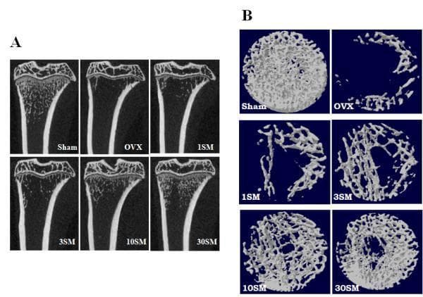 This diagnostic image set displays micro-computed tomography (μ-CT) analysis of rat medial-proximal tibiae, used as a preclinical model for postmenopausal osteoporosis. Panel A presents coronal cross-sections across six experimental groups: Sham control, Ovariectomized (OVX), and four dose-dependent treatment groups (1SM, 3SM, 10SM, 30SM). The Sham group shows robust trabecular bone density and thick cortical bone. The OVX group demonstrates significant osteopenia with a marked loss of trabecular architecture and cortical thinning. Treatment groups show a dose-dependent increase in trabecular volume, with the 30SM group appearing most similar to the Sham control. Panel B provides corresponding 3D reconstructions of the trabecular bone network. The images illustrate variations in trabecular connectivity and microarchitecture, highlighting the transition from a dense, interconnected honeycomb lattice in the Sham group to a fragmented, sparse structure in the OVX and low-dose groups, followed by gradual restoration of bone volume fraction (BV/TV) and connectivity density in the high-dose SM treatment groups. This visual demonstrates the efficacy of a therapeutic agent in preventing bone loss in a hormone-deficient model.