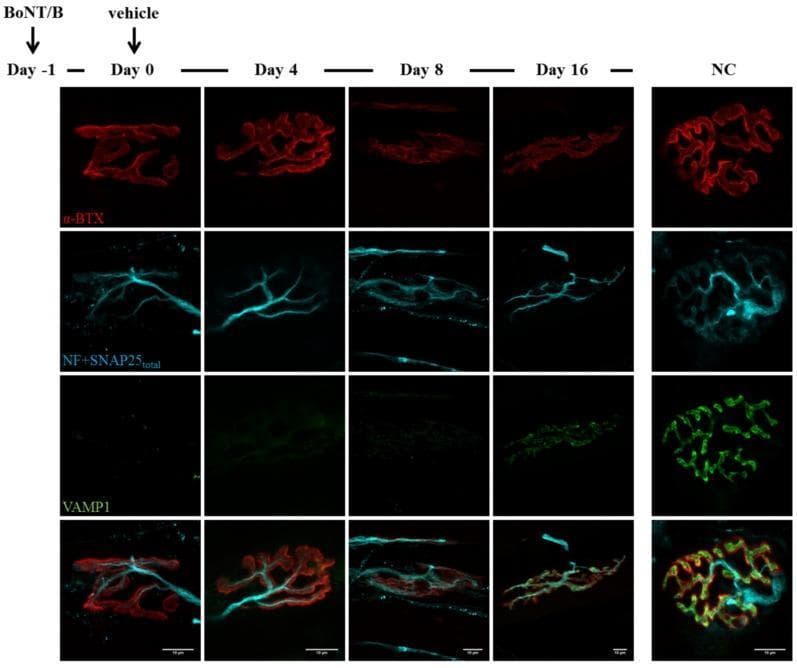 This diagnostic image illustrates a time course of immunohistochemistry staining in mouse soleus muscle following Botulinum neurotoxin serotype B (BoNT/B) injection to study neuromuscular junction (NMJ) recovery. The grid compares multiple time points (Day -1, Day 0, Day 4, Day 8, and Day 16) against a negative control (NC). Rows represent different molecular markers: alpha-bungarotoxin (alpha-BTX, red) for post-synaptic acetylcholine receptors; neurofilaments and total SNAP25 (NF+SNAP25 total, cyan) for pre-synaptic nerve terminals; and VAMP1 (green), a vesicle-associated membrane protein and the specific target of BoNT/B cleavage. At Day -1 and Day 0, VAMP1 staining is absent due to BoNT/B-mediated cleavage, while the alpha-BTX and NF+SNAP25 signals show initial terminal structure. By Day 8, the NF+SNAP25 signal appears fragmented, indicating nerve terminal disruption. Recovery is evident by Day 16, where newly synthesized VAMP1 (green) reappears at the NMJ, correlating with the re-establishment of pre-synaptic terminal morphology. The negative control shows robust, co-localized staining of all markers in a characteristic 'pretzel' shape. Scale bar = 10 µm.