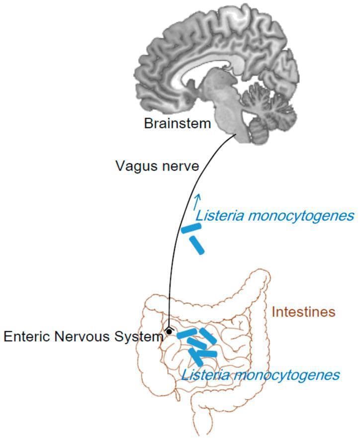 This pathophysiology diagram illustrates the 'gut-brain axis' as a potential retrograde axonal transport pathway for Listeria monocytogenes. The visual consists of three primary anatomical components: a sagittal section of the human brain highlighting the brainstem, an elongated line representing the vagus nerve (Cranial Nerve X), and a line-drawing of the small and large intestines. The diagram depicts the enteric nervous system within the intestinal wall as the starting point. Blue rod-shaped icons representing L. monocytogenes are shown within the intestinal lumen and alongside the vagus nerve, with an upward-pointing arrow indicating a centripetal progression from the gastrointestinal tract toward the brainstem. This educational illustration demonstrates the mechanism by which ingested pathogens may bypass the blood-brain barrier by traveling via autonomic nerve fibers to reach the central nervous system, specifically targeting the rhombencephalon. The content is suitable for medical students and clinicians studying infectious diseases, neurology, and neuroanatomy.