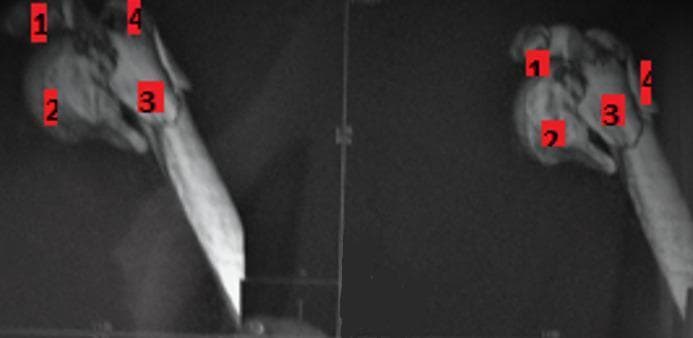 This diagnostic image consists of two Computed Tomography (CT) scan views (scout or 3D reformations) of the proximal humerus, demonstrating a complex 4-part fracture according to the Neer classification system. The image highlights a highly comminuted fracture involving the superior extremity of the humerus. Four distinct fragments are identified with red numerical labels (1 through 4): the articular humeral head, the greater tuberosity, the lesser tuberosity, and the humeral shaft (diaphysis). There is significant displacement and loss of anatomical alignment between the humeral head fragments and the surgical neck. The views (likely anteroposterior and a secondary oblique or axial orientation) provide a multi-planar assessment of the fracture pattern, crucial for surgical planning such as internal fixation with locking plates or arthroplasty. This clinical finding is typical of high-energy trauma in younger patients or low-energy falls in osteoporotic elderly populations within the domain of orthopedic traumatology.