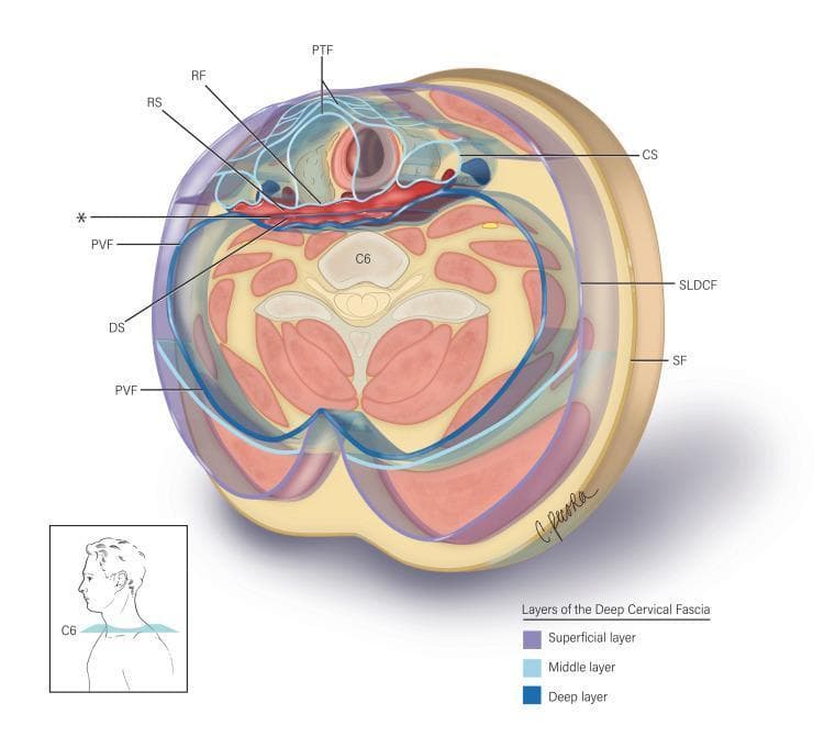 This medical anatomical diagram illustrates a transverse section of the neck at the C6 vertebral level, detailing the layers of the deep cervical fascia and the potential spaces they define. The illustration categorizes the fascia into three layers: superficial (yellow), middle (light blue), and deep (dark blue). Key anatomical structures labeled include the superficial fascia (SF), the superficial layer of deep cervical fascia (SLDCF), and the pretracheal fascia (PTF) enclosing the visceral compartment. Centrally, the diagram highlights the alar fascia (marked with an asterisk), which is situated between the retropharyngeal fascia (RF) anteriorly and the prevertebral fascia (PVF) posteriorly. This arrangement delineates two critical clinical spaces: the retropharyngeal space (RS), located between the RF and the alar fascia, and the 'danger space' (DS), situated between the alar fascia and the PVF. The carotid sheath (CS) is shown laterally. This visualization is essential for understanding the pathways of infection spread between the neck and the mediastinum, as well as providing anatomical guidance for surgical procedures in the prevertebral region.