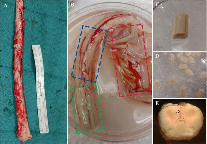This composite of clinical photographs illustrates the surgical extraction and micro-dissection of a human spinal cord specimen for neural stem/progenitor cell (NSPC) research. Panel A shows the full length of an extracted adult human spinal cord alongside a medical ruler for scale. Panel B displays the spinal cord submerged in dissection buffer, with colored dashed boxes identifying the three meningeal layers: the thick, opaque dura mater (red), the translucent arachnoid mater (blue), and the thin pia mater (green) closely adhering to the cord surface. Panel C shows a spinal cord segment after complete removal of the meninges, while Panel D depicts multiple transverse sections (1β2 mm thick) prepared for dissection. Panel E provides a high-magnification cross-sectional view of a single spinal cord segment, featuring an anatomical overlay: a red dashed line indicates the dissection path from the ventral sulcus toward the central canal, which is highlighted by a small red ellipse. This series demonstrates a laboratory protocol for isolating specific neuroanatomical regions from post-mortem human tissue.
