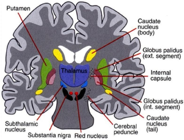 This medical illustration presents a coronal cross-section of the human brain, focusing on the neuroanatomical organization of the basal ganglia and related subcortical structures. The central feature is the thalamus, depicted in blue. Positioned laterally to the thalamus is the internal capsule, which serves as a landmark separating the thalamus from the lentiform nucleus, composed of the green-shaded putamen and the internal (pink) and external (maroon) segments of the globus pallidus. The caudate nucleus is visualized in yellow, with its body located superior-lateral to the thalamus and its tail visible at a lower lateral position. In the midbrain region inferior to the thalamus, the diagram highlights the subthalamic nucleus (light blue), the substantia nigra (black), and the red nucleus (red circles). Other identified structures include the cerebral peduncles and the surrounding cerebral cortex. This diagram is designed for educational use in neuroanatomy and neurology, illustrating the spatial relationships within the cortico-striatal-thalamo-cortical circuits involved in motor control and cognitive function.