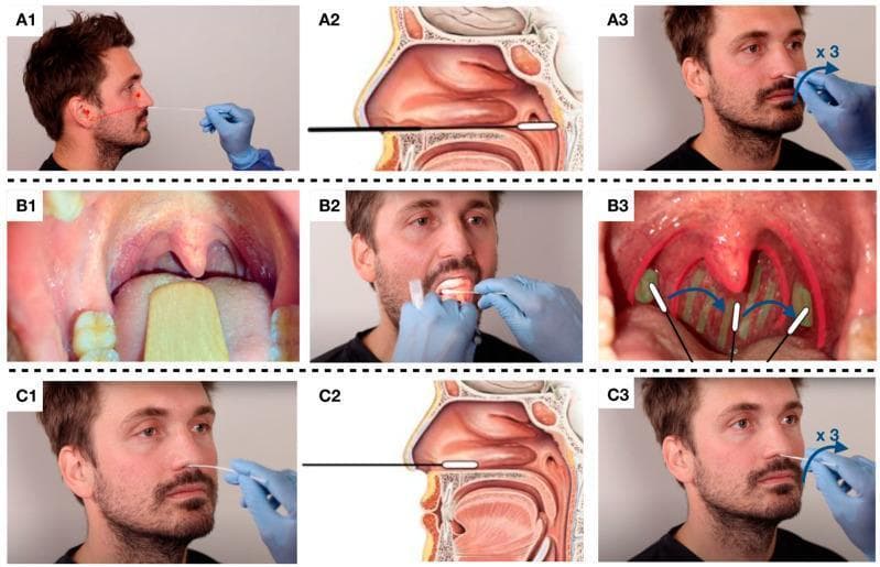 A multi-panel clinical instructional graphic demonstrating three types of upper respiratory tract specimen collection: nasopharyngeal swab (NPS), oropharyngeal swab (OPS), and nasal swab. Row A (NPS) shows a side-view clinical photo with a trajectory line toward the earlobe, followed by an anatomical cross-section illustrating a flexible swab reaching the posterior wall of the nasopharynx (8–11 cm depth), and a rotation step. Row B (OPS) displays intraoral views using a tongue depressor to visualize the oropharynx, with diagrammatic overlays highlighting the swabbing of the palatine tonsils and the posterior pharyngeal wall. Row C (nasal swab) illustrates a shallow insertion (1–3 cm) into the anterior nasal cavity, with an anatomical diagram showing contact with the septum and inferior nasal concha, followed by a triple-rotation technique. This infographic serves as a clinical guide for proper diagnostic sampling techniques in infectious disease screening, such as for COVID-19.