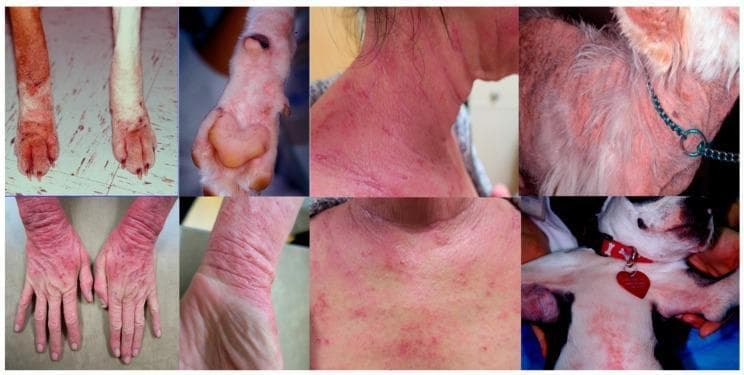 This clinical comparison chart displays eight photographs illustrating the manifestations of atopic dermatitis (AD) in both human and canine subjects. The images highlight a shared distribution pattern of inflammatory skin lesions across both species. In humans, clinical signs include diffuse erythema, lichenification, and scaling on the hands, wrists, neck, and upper chest. In canines, similar presentations of erythematous dermatitis are shown on the paws (pododermatitis), neck, and ventral chest (axillary region). Morphological features common to both species include intense redness and evidence of chronic irritation. The canine images specifically show secondary changes like alopecia, hyperpigmentation, and potential ulceration on the paws. The comparison serves to demonstrate the similarities in the clinical phenotype of AD across species, particularly targeting areas with high skin permeability and flexural surfaces. Educational focus is placed on recognizing these shared anatomical predilections—the face, neck, chest, and extremities—which are central to the diagnosis of allergic skin disease in a One Health clinical context.