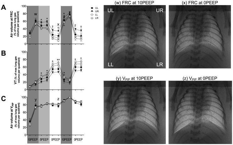 This composite educational graphic illustrates the effects of Positive End-Expiratory Pressure (PEEP) on regional lung aeration and gas volume during neonatal respiratory support. On the left, line graphs (A, B, C) track percentage changes in air volume at Functional Residual Capacity (FRC), Tidal Volume (VT), and Volume at Peak Inflation Pressure (VPIP) across four lung quadrants: Upper Left (UL), Upper Right (UR), Lower Left (LL), and Lower Right (LR). On the right, four phase-contrast X-ray images (w, x, y, z) provide visual comparisons of lung expansion. Images (w) and (x) compare FRC at 10 PEEP versus 0 PEEP, demonstrating that higher PEEP maintains significantly greater radiolucency and alveolar recruitment, particularly in the lower lobes. Images (y) and (z) compare VPIP at 10 PEEP versus 0 PEEP, showing that while peak inflation improves aeration, 0 PEEP (z) results in reduced lung volume and increased radio-opacity compared to the uniform expansion seen at 10 PEEP (y). The data highlights the role of PEEP as an internal splint to prevent atelectasis in compliant neonatal lung tissue.