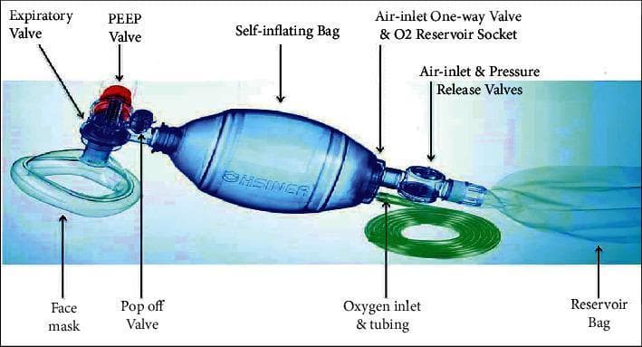 This clinical photograph and labeled diagram illustrate a standard AMBU bag (Artificial Manual Breathing Unit) system, also known as a bag-valve-mask (BVM) resuscitator, used for manual ventilation. The central component is a blue self-inflating bag, which is manually compressed to deliver tidal volume. On the proximal (patient) end, the bag connects to a clear face mask via a assembly containing a pop-off valve (pressure-limiting valve), an expiratory valve, and a PEEP (positive end-expiratory pressure) valve with a distinctive red adjustment knob. On the distal (input) end, the system includes an air-inlet one-way valve, an oxygen reservoir socket, and air-inlet and pressure release valves. Attached to this distal end is a green oxygen inlet tubing and a large, translucent green reservoir bag, which ensures high oxygen concentration delivery. The image serves as an educational guide to the pneumatic circuit and component relationships necessary for emergency airway management and basic life support.