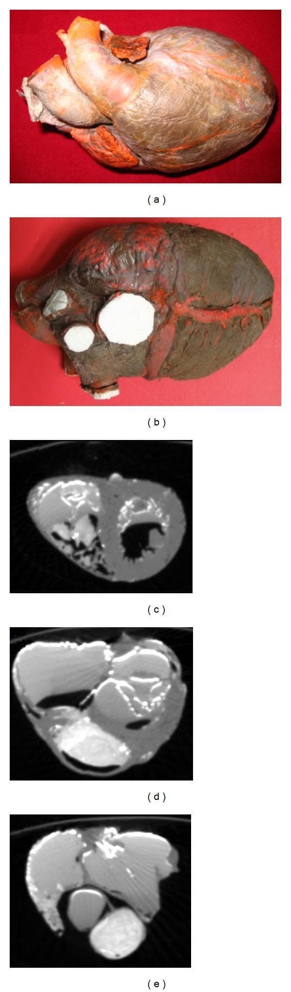 Educational panel illustrating human cardiac anatomy through gross specimen photography and Computed Tomography (CT). The upper section contains two clinical photographs of a human heart specimen: (a) a frontal view showing the anterior surface, large vessels (aorta and pulmonary artery), and surface musculature, and (b) a posterior view highlighting white circular patches where vessels were prepared and the darker diaphragmatic surface. The lower section features three axial CT slices demonstrating the heart's internal architecture across different planes: (c) at the ventricular level, showing the thicker left ventricular wall compared to the right; (d) a mid-level slice capturing the spatial transition between atria and ventricles; and (e) a superior slice focusing on the atrial chambers. The CT images utilize contrast-enhancing materials (lead oxide and gelatin) to delineate the endocardial borders and myocardial thickness, serving as a primary dataset for 3D anatomical reconstruction and fiber orientation modeling in cardiovascular research.