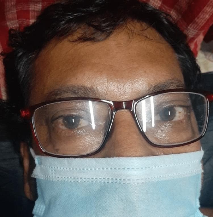Clinical photograph of a 53-year-old male presenting with bilateral Graves' ophthalmopathy (thyroid eye disease). The image focuses on the periocular region, demonstrating bilateral exophthalmos (proptosis) characterized by the protrusion of the globes from the orbits. Significant scleral show is visible, particularly inferior to the iris, contributing to a characteristic 'staring' expression or Dalrymple's sign. The patient is wearing corrective eyeglasses and a surgical face mask, indicating a clinical setting. This visual illustrates the extrathyroidal manifestations of Graves' disease, an autoimmune condition causing hypertrophy of extraocular muscles and orbital adipose tissue. The image is an educational resource for medical professionals to recognize clinical signs of hyperthyroidism-associated orbitopathy and for calculating Clinical Activity Scores (CAS) in endocrinology and ophthalmology.