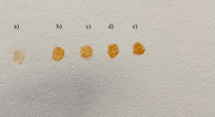 This Comparison Chart illustrates the results of a filter paper test used to evaluate the intensity of staphyloxanthin pigment production by Staphylococcus aureus clinical isolates across five different growth media. The image displays five distinct pigmented spots labeled (a) through (e) on a white filter paper background. From left to right, the spots correspond to cultures grown on: (a) Nutrient agar, (b) Milk agar, (c) Carrot agar, (d) Beetroot with carrot agar, and (e) Beetroot agar. A clear progression in color intensity and hue is visible, shifting from a very pale, translucent tan in spot (a) to a deeply saturated orange-gold in spot (e). The visual evidence demonstrates that beetroot-supplemented media (d and e) promotes the highest levels of staphyloxanthin expression, a key virulence factor in S. aureus. This diagnostic comparison is used in microbiology and clinical pathology research to study the influence of nutritional components on bacterial phenotypic characteristics and biosynthetic pathways.