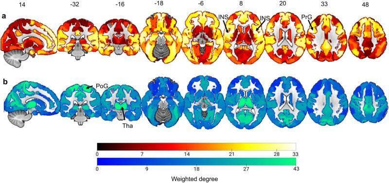 Diagnostic neuroimaging diagram illustrating maps of brain region importance scores related to sleep health. The image consists of two panels, (a) and (b), each featuring a series of axial fMRI brain slices and a single sagittal view. These maps represent resting-state functional connectivity (RSFC) loadings summed for regions in the Brainnetome atlas.
Panel (a) depicts the positive network importance scores using a warm color gradient (dark red to yellow to white), with values ranging from 0 to 33. Specific anatomical labels include the Insular Gyrus (INS) in slices 8 and 20, and the Precentral Gyrus (PrG) in slice 33.
Panel (b) depicts the negative network importance scores using a cool color gradient (dark blue to cyan/green), with values ranging from 0 to 43. Key identified regions include the Postcentral Gyrus (PoG) and the Thalamus (Tha), visible in slices -32 and -16.
This visualization demonstrates the spatial distribution of brain nodes that covary with sleep health dimensions, highlighting the functional importance of subcortical, somatomotor, and insular regions in sleep-related connectome biomarkers.