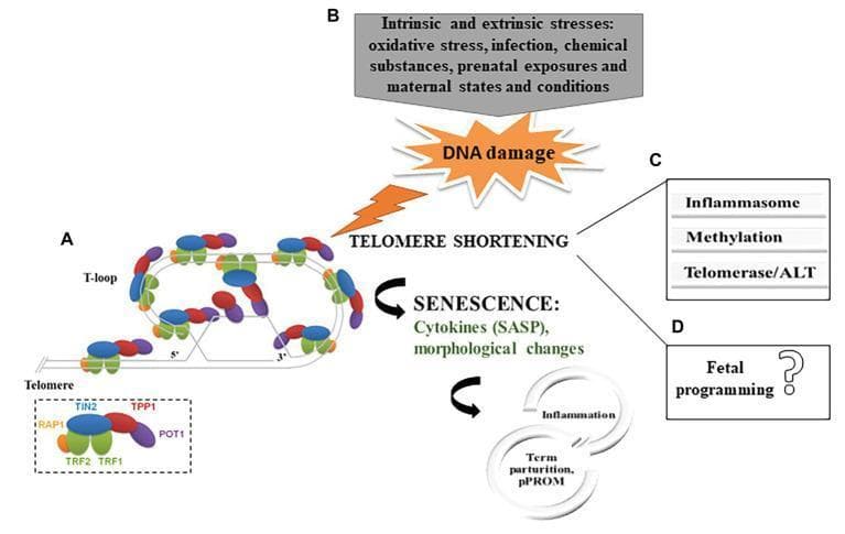 This medical infographic illustrates the role of telomere biology in parturition and gestational outcomes. Section A depicts the molecular structure of a telomere, showing the double-stranded DNA folding into a protective T-loop. It identifies the six-protein shelterin complex: TRF1, TRF2, RAP1, TIN2, TPP1, and POT1, highlighting their interaction with the 3' overhang. Section B outlines a pathophysiological pathway where intrinsic and extrinsic stressors (oxidative stress, infection, toxins) trigger DNA damage and subsequent telomere shortening. This shortening leads to cellular senescence, characterized by morphological changes and the release of cytokines (Senescence-Associated Secretory Phenotype, or SASP), ultimately driving inflammation associated with term parturition or preterm premature rupture of membranes (pPROM). Section C lists molecular consequences of telomere shortening, including inflammasome activation, altered methylation, and regulation of telomerase or Alternative Lengthening of Telomeres (ALT). Section D notes the currently uncertain link between fetal membrane telomere dysfunction and fetal programming.