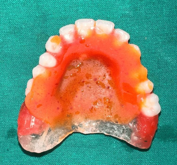 Hugging Face pmc clinical VQA raw