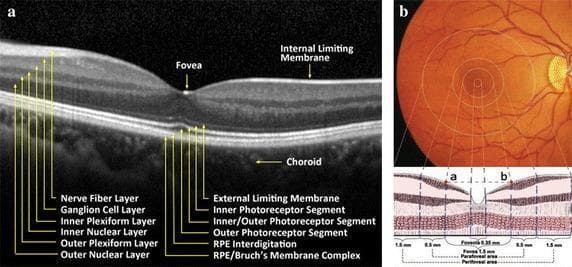 This educational image displays the normal anatomy of the human retina and macula through diagnostic imaging and anatomical diagrams. Panel (a) is a high-resolution optical coherence tomography (OCT) cross-section of a normal retina, with detailed labels identifying 12 distinct layers: Nerve Fiber Layer (NFL), Ganglion Cell Layer (GCL), Inner Plexiform Layer (IPL), Inner Nuclear Layer (INL), Outer Plexiform Layer (OPL), Outer Nuclear Layer (ONL), External Limiting Membrane (ELM), various segments of the Photoreceptors, RPE Interdigitation, RPE/Bruch's Membrane Complex, and the underlying Choroid. A characteristic central foveal depression is clearly visible. Panel (b) provides a composite of a clinical fundus photograph and a matching cross-sectional anatomical diagram illustrating macular regional division. The macula is subdivided into concentric zones with specific diameters: the foveola (0.35 mm), fovea (1.5 mm), parafovea (an additional 0.5 mm ring), and perifovea (an additional 1.5 mm ring). The content is designed for medical education in ophthalmology, specifically for understanding normal fundus morphology and interpreting OCT scans for diagnostic purposes.