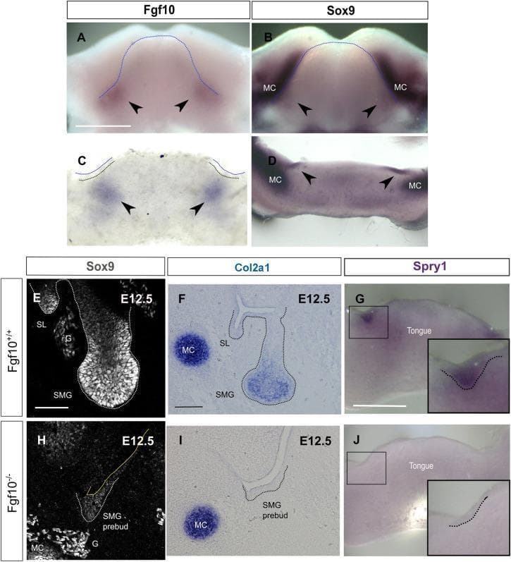 This composite educational graphic illustrates the regulatory role of Fgf10 in Sox9 expression during embryonic salivary gland development. Panels A-D use in situ hybridization to demonstrate the spatial overlap of Fgf10 and Sox9 mRNA in the E11.0 murine mandible and frontal mandibular slices, with arrowheads highlighting expression at the site of submandibular gland (SMG) initiation. Meckel’s cartilage (MC) is noted as a landmark. Panels E-J provide a comparison between wild-type (Fgf10+/+) and mutant (Fgf10-/-) embryos at E12.5. Immunofluorescence (E, H) and in situ hybridization (F, G, I, J) show that loss of Fgf10 results in a significant reduction of Sox9 protein, Col2a1 mRNA, and Spry1 mRNA within the SMG epithelium. While the wild-type (Fgf10+/+) samples exhibit well-defined epithelial buds with robust expression of these markers, the Fgf10-/- mutants display arrested 'pre-bud' morphology and diminished signaling. These findings establish Fgf10 as a critical upstream regulator of the Sox9-Col2a1 pathway necessary for epithelial branching morphogenesis.