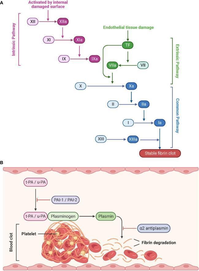 This medical schematic illustrates the physiological processes of hemostasis and fibrinolysis. Part A depicts the Coagulation Cascade, divided into the Intrinsic, Extrinsic, and Common pathways. The Intrinsic pathway (purple) is triggered by internal damaged surfaces, activating Factor XII to XIIa, followed by XI and IX. The Extrinsic pathway (green) begins with endothelial tissue damage and Tissue Factor (TF), activating Factor VII to VIIa. Both pathways converge at the Common pathway (blue) starting with the activation of Factor X to Xa. This leads to the conversion of prothrombin (II) to thrombin (IIa), and fibrinogen (I) to fibrin (Ia), culminating in a stable fibrin clot stabilized by Factor XIIIa. Activated factors are denoted by an 'a' suffix. Part B illustrates Fibrinolysis, where tissue-type (t-PA) and urokinase-type (u-PA) plasminogen activators convert plasminogen to plasmin, which then degrades the fibrin network of the blood clot. Inhibitory regulators including PAI-1, PAI-2, and ̡2-antiplasmin are also shown. The diagram represents the structural breakdown of a clot containing platelets and red blood cells into fibrin degradation products.